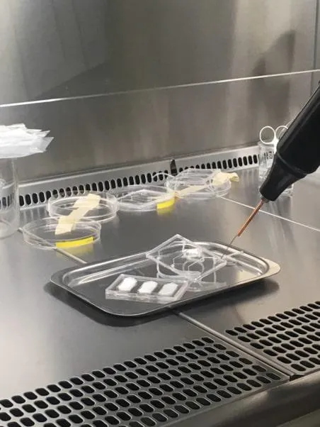 The image is an organ-on-a-chip system where we culture human breast cells in 3D. This system allows us to culture cells, in the lab, in a way that replicates the architecture and environment of the human breast to study the initiation, progression and treatment of breast cancer. These systems are being developed in many areas of biomedical sciences to replace or reduce the reliance on animal studies.