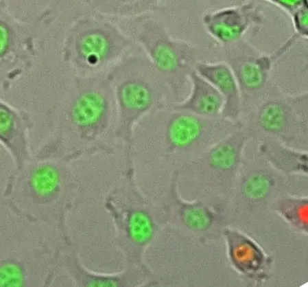 Transduced human cells: Green stains nuclei in which chromosomes are modified by the viral vector.