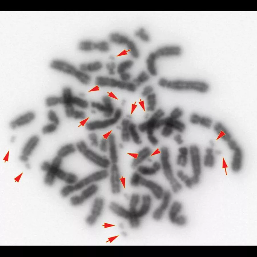 The picture shows the chromosomes from one colorectal cancer cell cultured in the laboratory. The larger dark grey forms are whole chromosomes where as the small dots indicated by the red arrows are chromosomal fragments called double minutes that have broken off the main chromosomes. Double minutes are frequently found in cancer cells and the genes within them are often expressed incorrectly causing the cells to grow too fast.