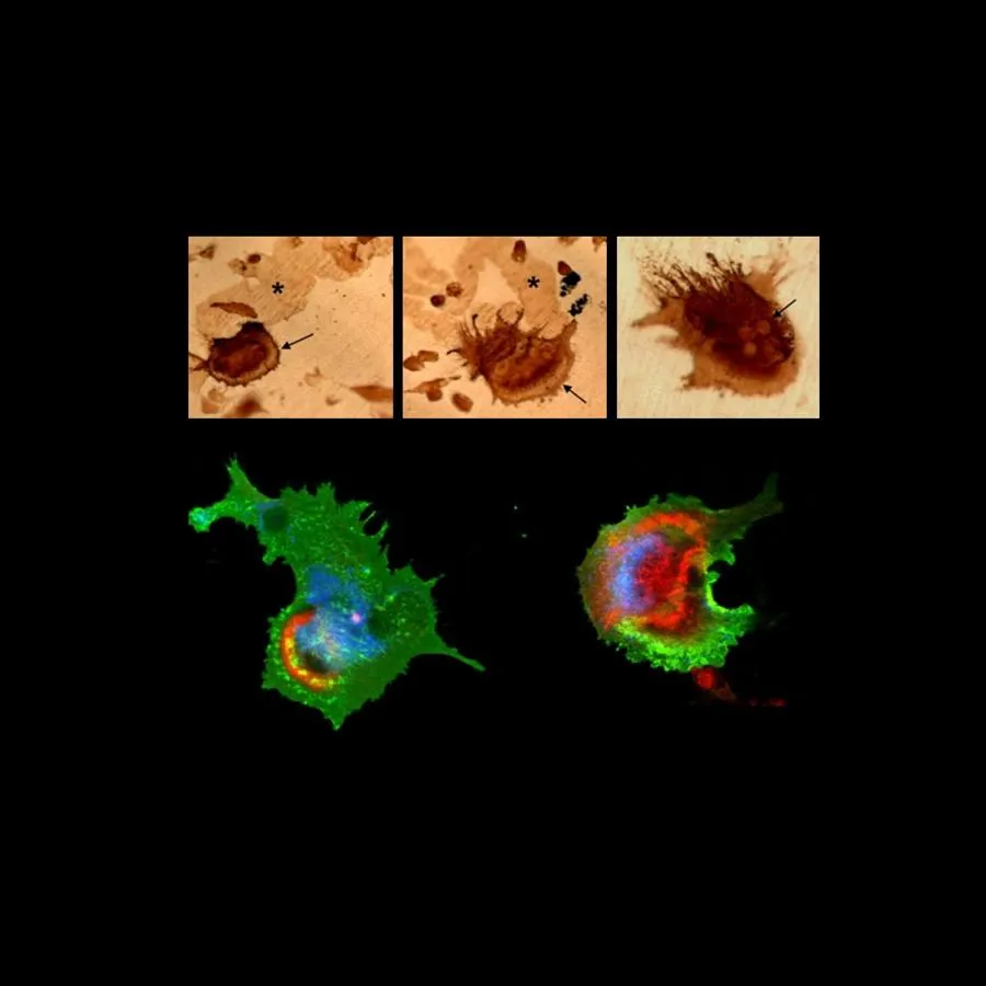 Expression of mature osteoclast markers. VNR expression are present in actively resorbing, multinucleated osteoclasts. Resorption trails are clearly visible in panels E-G (*).. Bottom two images are collected using laser confocal microscopy of the coexpression of β3 integrin (green), F-actin rings (red), and cathepsin K (blue) in osteoclasts.