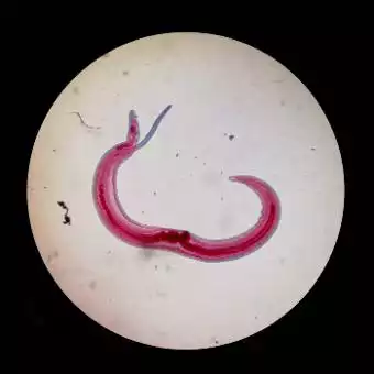 Parasitology slide of Schistosoma
