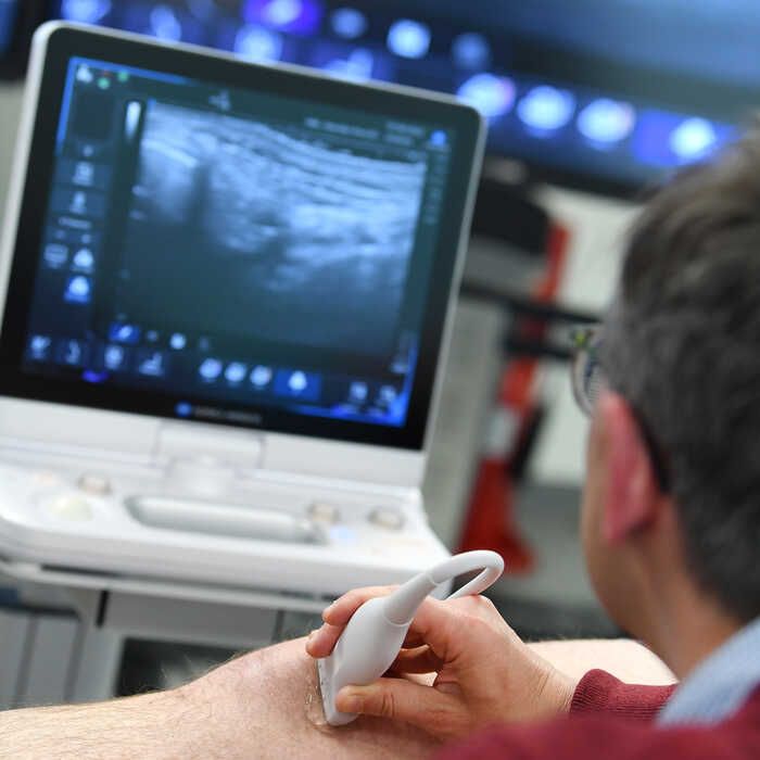 Person using an ultrasound machine with a probe