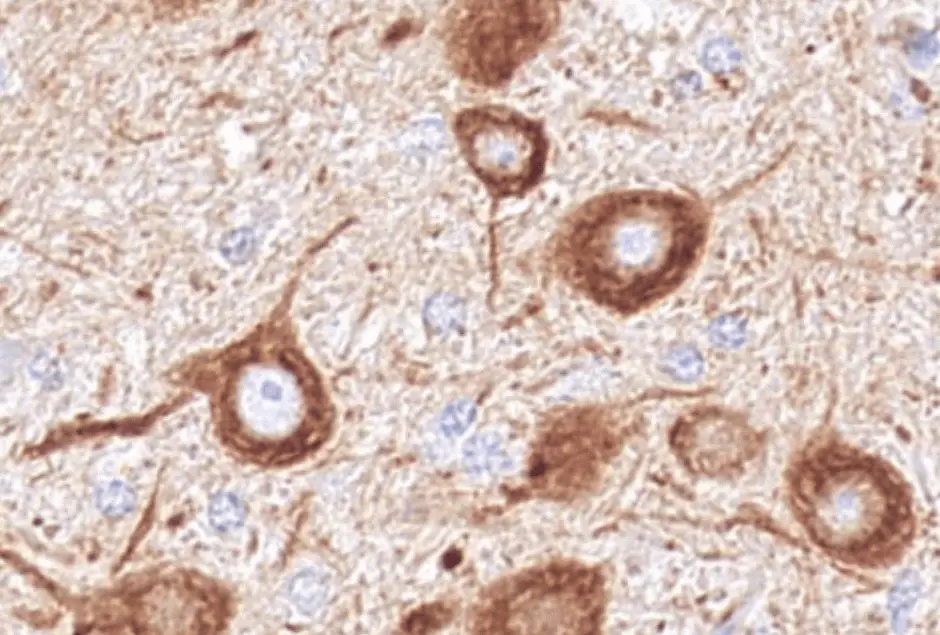 Exp-Gene-Banner