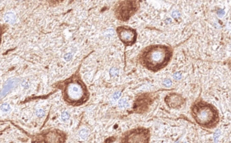 image of Experimental gene therapy raises hope for children with fatal neurological disease