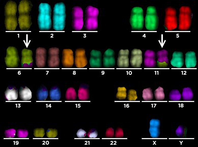 M-FISH-painted-chromosomes-showing-reciprocal-translocation