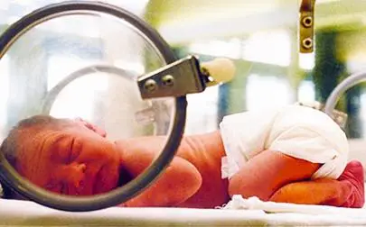 image of Surprise discovery could accelerate treatments for premature babies