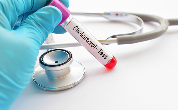 image of Cholesterol flags violence risk in people with schizophrenia