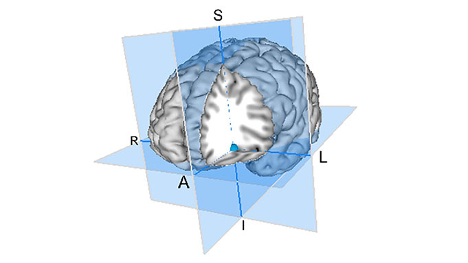 left inferior frontal gyrus