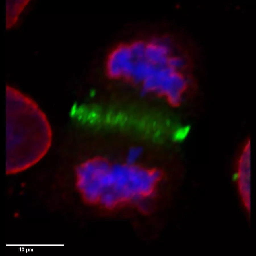 The image shows a human cell that has just divided the DNA (in blue) and soon will split all the other components and generate two identical cells. The red colour shows the Nuclear Membrane that will encapsulate and protect the DNA and in green the machinery that will cleave and separate the new-born sister cells.This process is called Cell division. It is a fundamental process at the basis of our existence. From the single cell at conception, about 37.2 trillion cells are generated to make up an adult human being. Divisions need to occur in an extremely accurate manner to produce cells that are healthy and viable. Defects in cell division are responsible for several human pathologies ranging from Down syndrome to cancer. Our research aims to understand how cell division occurs faithfully and how mistakes are avoided.  These studies would lead us to better diagnostic tools and intervention opportunity to either prevent or cure some of these diseases.