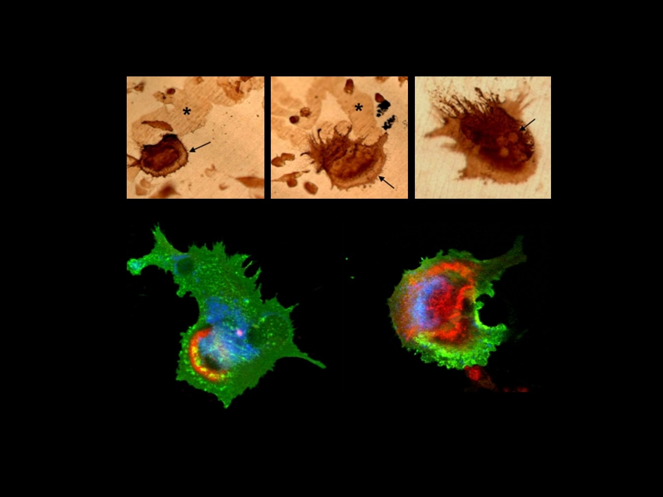 Expression of mature osteoclast markers. VNR expression are present in actively resorbing, multinucleated osteoclasts. Resorption trails are clearly visible in panels E-G (*).. Bottom two images are collected using laser confocal microscopy of the coexpression of β3 integrin (green), F-actin rings (red), and cathepsin K (blue) in osteoclasts.