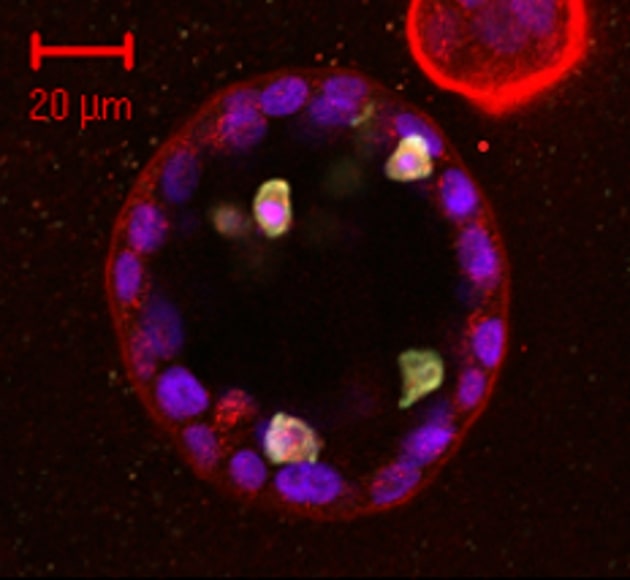 The image is a confocal microscope image of a 3D structure of breast cells, called acini. These cells were cultured in a gel-like scaffold, called matrigel, where they formed 3D acini that resemble milk ducts in human breast. This is formed by a layer of cells (epithelial cells) encapsulated by a membrane (basement membrane) and surrounding a hollow lumen (centre). In humans, milk would flow through the lumen. This system allows us to study breast cancer in a system that is more representative of the structure and function of the breast than traditional culture methods (where cells are grown in flat surfaces - 2D).