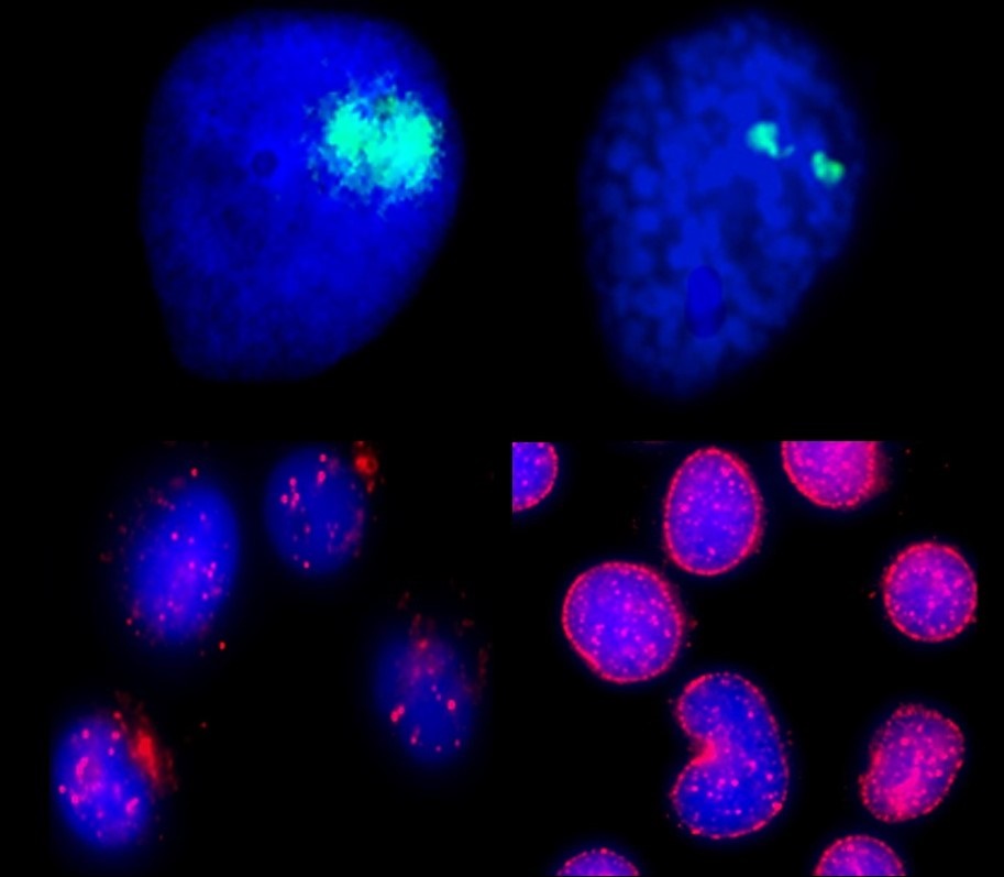 The Rams Horn Snail and host of the human parasitic disease Bilharzia.The top row displays whole chromosome territories in green in cell nuclei in blue extracted from whole snails. The bottom row reveal in red nuclear bodies and nuclear motor proteins as observed  in human cells, which we have proven move chromosomes and genes around to specific locations in cell nuclei. We believe given the similarity of the genome behaviour and nuclear structure in these animals they make an excellent whole organism model to study ageing, cancer and dementia.