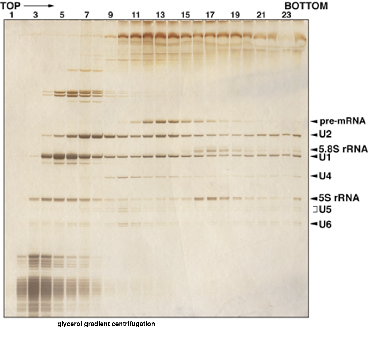 Precursor messenger RNA (pre-mRNA) splicing is a cellular process in which non-coding sequences (introns) are removed and coding sequences (exons) are joined together to generate mRNA for protein production in cells. Splicing is somewhat similar to film editing: if it is not done properly, two unmatched scenes may be stitched together in one episode, which would not make sense. In splicing, if exon-intron boundaries are not correctly identified, the wrong mRNA will be produced. From this a faulty protein will be synthesised, and it may cause disease. This happens in splicing of LMNA gene that leads to production of the aberrant protein, Progerin, which, in turn, causes premature ageing. Thus, the LMNA pre-mRNA splicing can be used as a tool to investigate the mechanisms that regulate human longevity. Our aim is to identify the proteins that play a key role in modulating the outcomes of the LMNA pre-mRNA splicing via comparative proteomic analysis. Since the identified proteins are likely to affect the speed of the ageing process, the pharmaceutical targeting of these proteins - inhibition of their function by small interacting molecules - may lead to the discovery of novel drugs capable of extending human life span.The image is of a gel that demonstrates how to reveal all the components of a spliceosome by elution and employing a glycerol gradient.