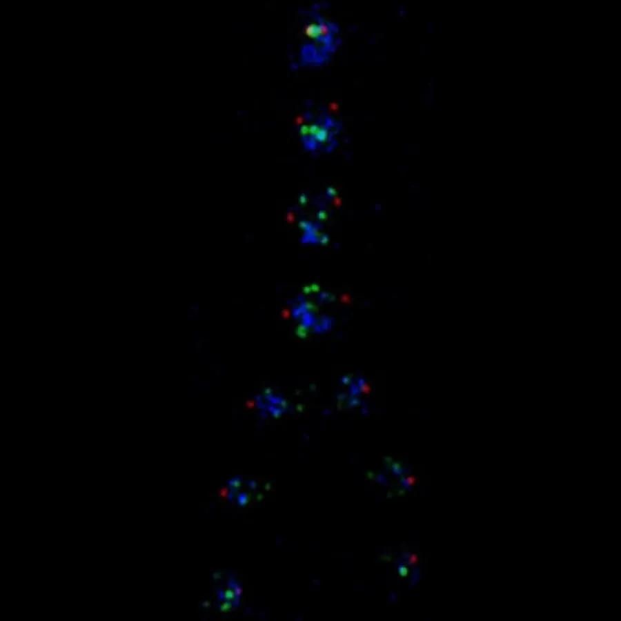 Cell division, Mitosis – chromosome segregation: Green: telomeres (chromosome ends); Blue: chromosome body where condensed; Red centrosomes (pole bodies that pull chromosome into daughter cells)
