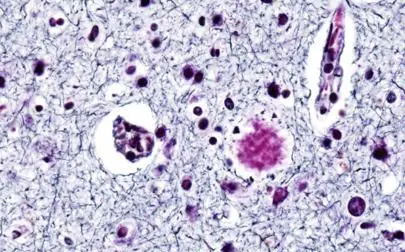 image of Living Well with Dementia