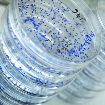 Stacked petri dishes with blue-stained bacteria colonies and handwritten labels.