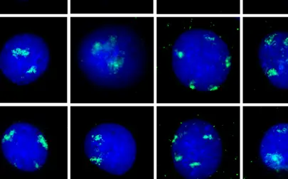 image of Innovations in Breast Cancer Workshop