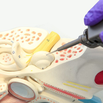 structure of inner ear with implant