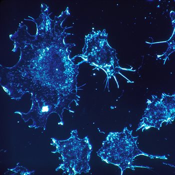 cancer cells