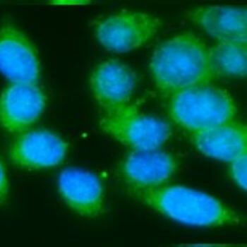 Fluorescent microscopic image showing cells with bright blue nuclei and green cytoplasm.