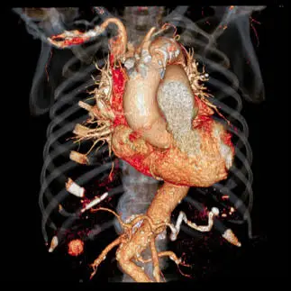 heart organs