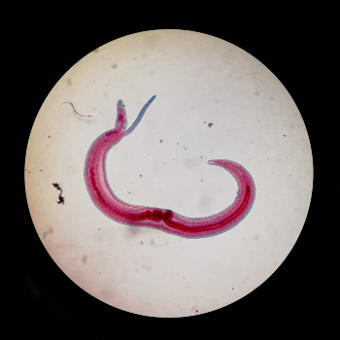 Parasitology slide of Schistosoma