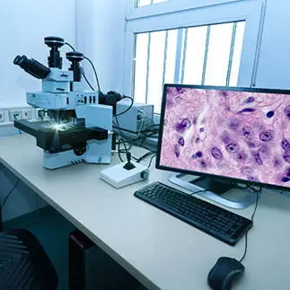 Digital histopathology image of microscope alongside computer with monitor showing a scan