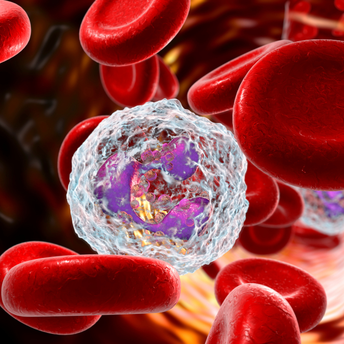 sickle cell